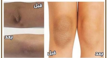 کرم روشنکننده و رفع تیرگی بدن ایچون اورجینال